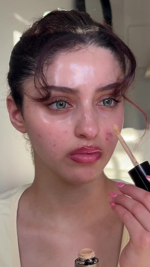 Acne Coverup Tutorial: Easy Color Corrector Hack for Acne-Prone Skin