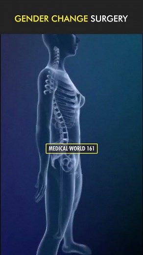 Gender Change Surgery 3D Animation #lgbt #genderchange #genderchangechallenge #genderchanger #genderaffirmingsurgery #genderchangesurgery #genderaffirming #genderaffirmation #genderaffirmationsurgery #genderaffirmationg #maletofemale #femaletomale #transgender