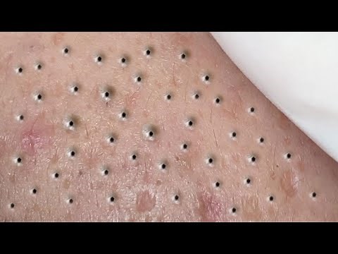 Satisfying Relaxing with Sac Dep Spa Video (#183)