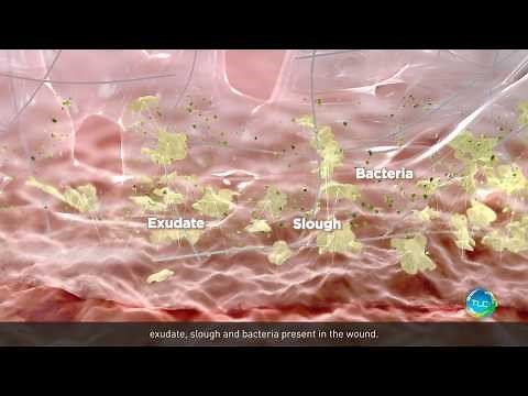 UrgoClean Ag Complete and Continuous Cleaning Action