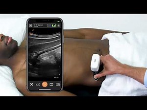 Scanning Technique: Appendix