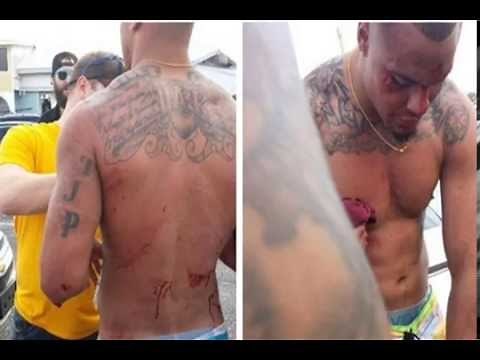 Mississippi State QB Dak Prescott battered in Panama City Beach