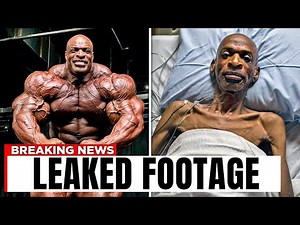 11 Bodybuilders Who Lost Their Physique After Retirement