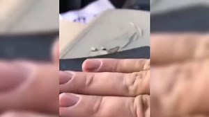 Advanced Leather Repair Gel, 2Pcs Upgrade Leather Repair Gel Professional DIY Leather and Vinyl Repair Kit Leather Repair Paint Gel, Leather Scratch Repair for Car (Blue, 20ml 2Pcs)