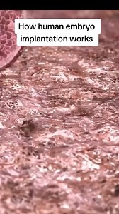 how a human embryo implants into the uterus to cause a pregnancy #infertility #IVF #ttc #infertilitywarrior #ivfwarrior #infertilityjourney #Reels #reelsvideo #reelsviral #reelinstagram | Steven Palter