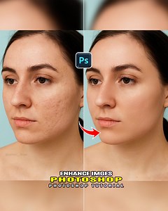 12K views · 111 reactions | Master in Photoshop | How to remove facial scars and acne using Photoshop |#photography #artist #music #Facebook #fblifestyle #photoshop #tutorial #follow #everyone #foryouシ #highlights #photochallenge #facebookpost #personaldevelopment | Smart Graphic Trick | Facebook