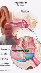 A lot of people have asked about the ear tube surgery so I thought I would explain a bit for those that want to know more. | Joshua Pettit
