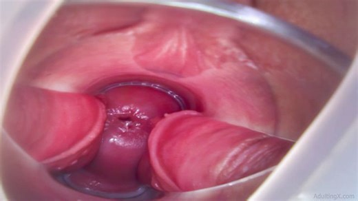 4 Orgasms with Speculum Cervix View - Preview