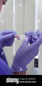 Blood collection, Nurse taking blood sample for analysis. Nurse taking a blood sample for medical examinations. The doctor or nurse will take a blood sample from a vein for testing.