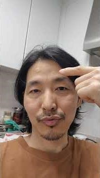 Before and after removing sebaceous cysts ~~~~