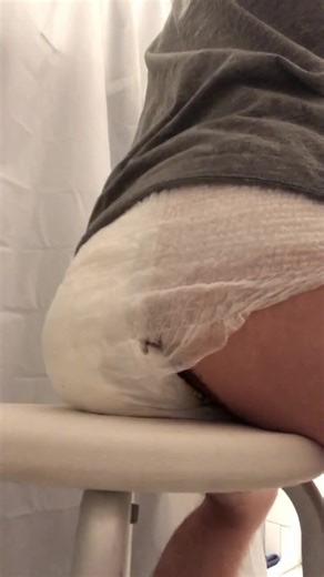 Bad Diaper Blowout Too much poop