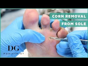 Sweet granny and her deep corn removal from sole