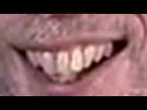 The Michael Rosen Mouth