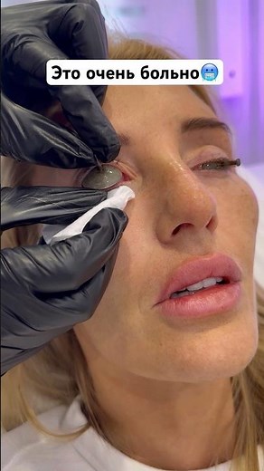 DON'T GET A TATTOO AT ALL😂 #tattoos #tattooremoval #pain