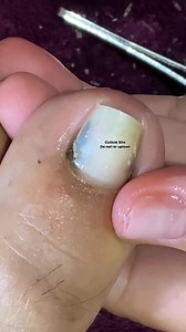 2.1M views · 16K reactions | #pedicure #fblifestyle | Cuticle Site | Facebook