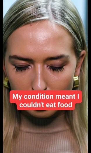 1.3M views · 9K reactions | My condition meant I couldn't eat food #truly #borndifferent #reels #awareness | Born Different | Facebook