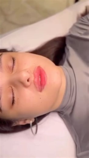 ЭЛЕН | КОСМЕТОЛОГ• АЛЕКСАНДРИТОВЫЙ ЛАЗЕР • УВЕЛИЧЕНИЕ ГУБ on Instagram: "Натурально?) коррекция формы губ «Чайка»"