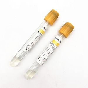 [Hot Item] Vacuum Tube Gel Separate The Serum Golden Yellow Cap