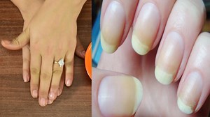7.7K views · 93 reactions | How to Keep Nails Clean and White? : A Quick Nail Cleaning Tutorial! #beauty #beautytips #Nailcaretips | Boldsky | Facebook