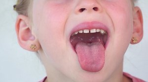 Little Girl Show Tongue Throat Child Stock Footage Video (100% Royalty-free) 1079931182 | Shutterstock
