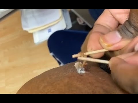 Punto nero inguardabile