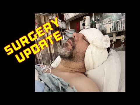 Surgery Update - Labyrinthectomy, Cochlear Implant, and My Struggle With Meniere’s Disease