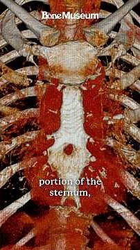 Sternal Foramen Explained: The Tiny Hole in the Human Breastbone