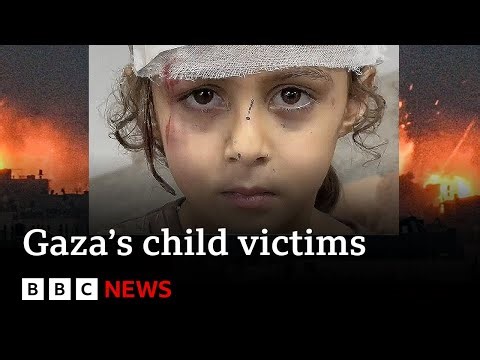 The children suffering under Israel’s onslaught - BBC News