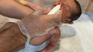 1.6K views · 20 reactions | Newborn baby _ Severe Chest Infection, Sinusitis & Skin Rash Treatment #BabyCare#chest infection #fetus #pregnancy #nicucare | Ashish Kumar Gautam | Facebook