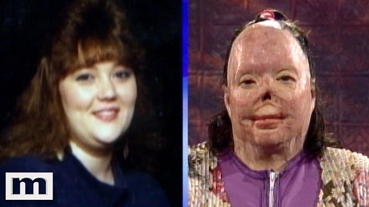 Kathryn says it's a miracle she's alive after being burned over 47% of her body. Kathryn was burned so badly that she lost her nose, fingers and one of her hands. Kathryn says her family's the reason she survived this terrible accident. #Maury23 #ViralVault | MAURY