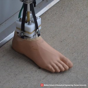 435K views · 1.9K shares | This intelligent prosthetic ankle can adapt to almost any surface.. | Interesting Engineering | Facebook