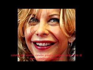 Meg Ryan plastic surgery