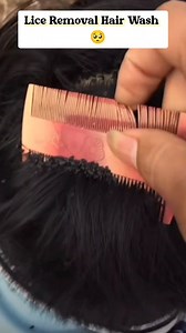 1.3M views · 2.7K reactions | Lice Removal Shampoo Hack/ Shampoo Hack For Lice Removal #shorts #hairwash #haircare #shampoo #reelsfbシ #beautywithsunanda #fbreelsfypシ゚ #viralreels #fbreels #fypviralシ #fbreelsvideo #reelsfypシ #reels2024 #reelsvideo #reelsfb #fypviral | Beauty With Sunanda | Facebook