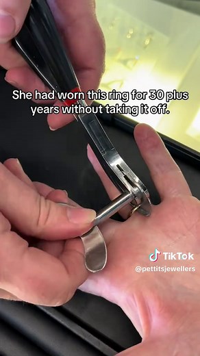 Ring Stuck on Finger: Safe Removal and Care Tips