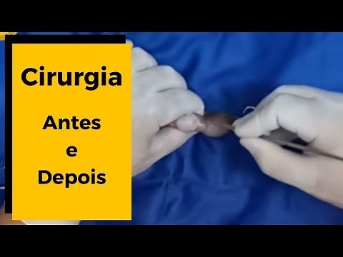 🚫 CACHORRO CASTRADO CIRURGIA - Como fica o saco do cachorro castrado ?