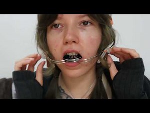 Bracesforfun Video 7 YT