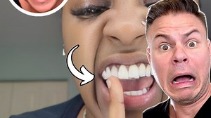 Watch How Dentists Turn Gold Into Stunning Grills! 😬🦷 #grills #teeth #holiday #nye | TheBentistofficial