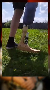 1M views · 273 reactions | Jab Cancer ki wajah se apni taang khone ke...