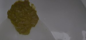 Korean girl diarrhea 10