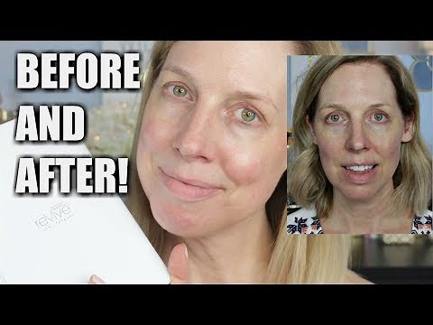 BEFORE AND AFTER! Revive Light Therapy Results!