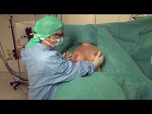 La réduction mammaire par le Dr Jean Masson chirurgien plasticien