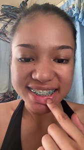 Purple Toothpaste for Teeth Whitening | USmile Oral Care