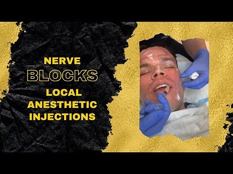 Nerve Blocks | Local Anesthetic Injections | West Hollywood, CA | Dr. Jason Emer