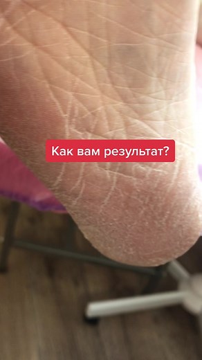 Human Foot Health: Exploring Skin Texture and Condition