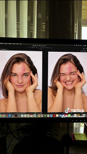 Beauty Model with a Unique Birthmark Journey