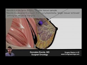 Needle Localization Biopsy - Complementary Med-School Video from Sx Basics in 4D (Interactive Book)