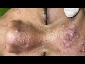 Relax Every Day SacDepSpa #787 (Hau P1)