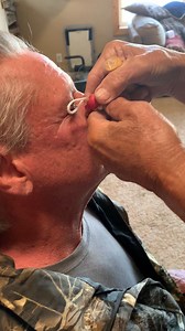 3M views · 9.2K reactions | Barbed hook in the eyebrow  We used the Look-No-Hook tool — no ER, no stitches.  Get yours here: https://looknohook.com ⚠️ We do not recommend removing hooks near the eye. This is a real emergency example. Always use caution. #fishingaddict #fishinglife #LookNoHook #emergency #ReelLife #fish #TackleBoxEssentialsl #fishing #fishingaddict #fishingtrip | Hook&Trail | Facebook