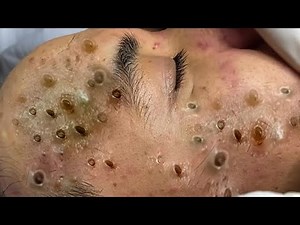 𝘼𝙘𝙝𝙞𝙚𝙫𝙚 𝙄𝙣𝙣𝙚𝙧 𝙋𝙚𝙖𝙘𝙚 𝙬𝙞𝙩𝙝 𝙏𝙝𝙚𝙨𝙚 𝙁𝙖𝙘𝙞𝙖𝙡 𝘾𝙡𝙚𝙖𝙣𝙨𝙞𝙣𝙜 𝙈𝙚𝙩𝙝𝙤𝙙𝙨