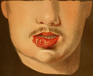 How One Local Health Clinic Is Dealing with the Gay Male STD Crisis